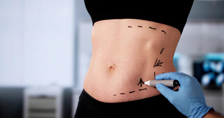 Mumbai, Health, Advanced Abdominoplasty In Mumbai &ndash; Natural Results