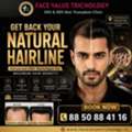Get Back Your Natural Hairline With Advanced HDI Technology
