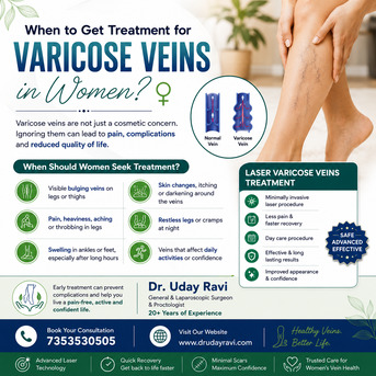 Bangalore, Health, When Should Women Seek Treatment For Varicose Veins? - Dr. Uday Ravi