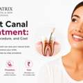 Advanced Root Canal Treatment In Delhi For Tooth Pain Relief