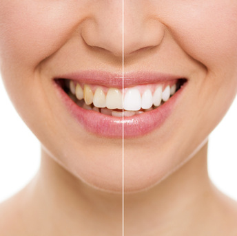 New York, Dental, Quality Cosmetic Dentistry Dunwoody Care