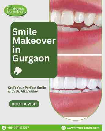 Gurgaon, Dental, Smile Makeover In Gurgaon For A Confident Smile | Thyme Dental