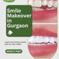Smile Makeover In Gurgaon For A Confident Smile | Thyme Dental