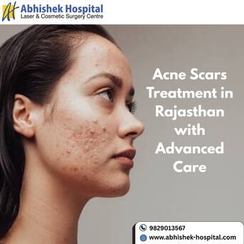 Jaipur, Health, Acne Scars Treatment In Rajasthan With Advanced Care