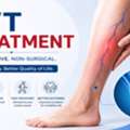 Non-Surgical DVT Treatment | Dr. Akash Bansal