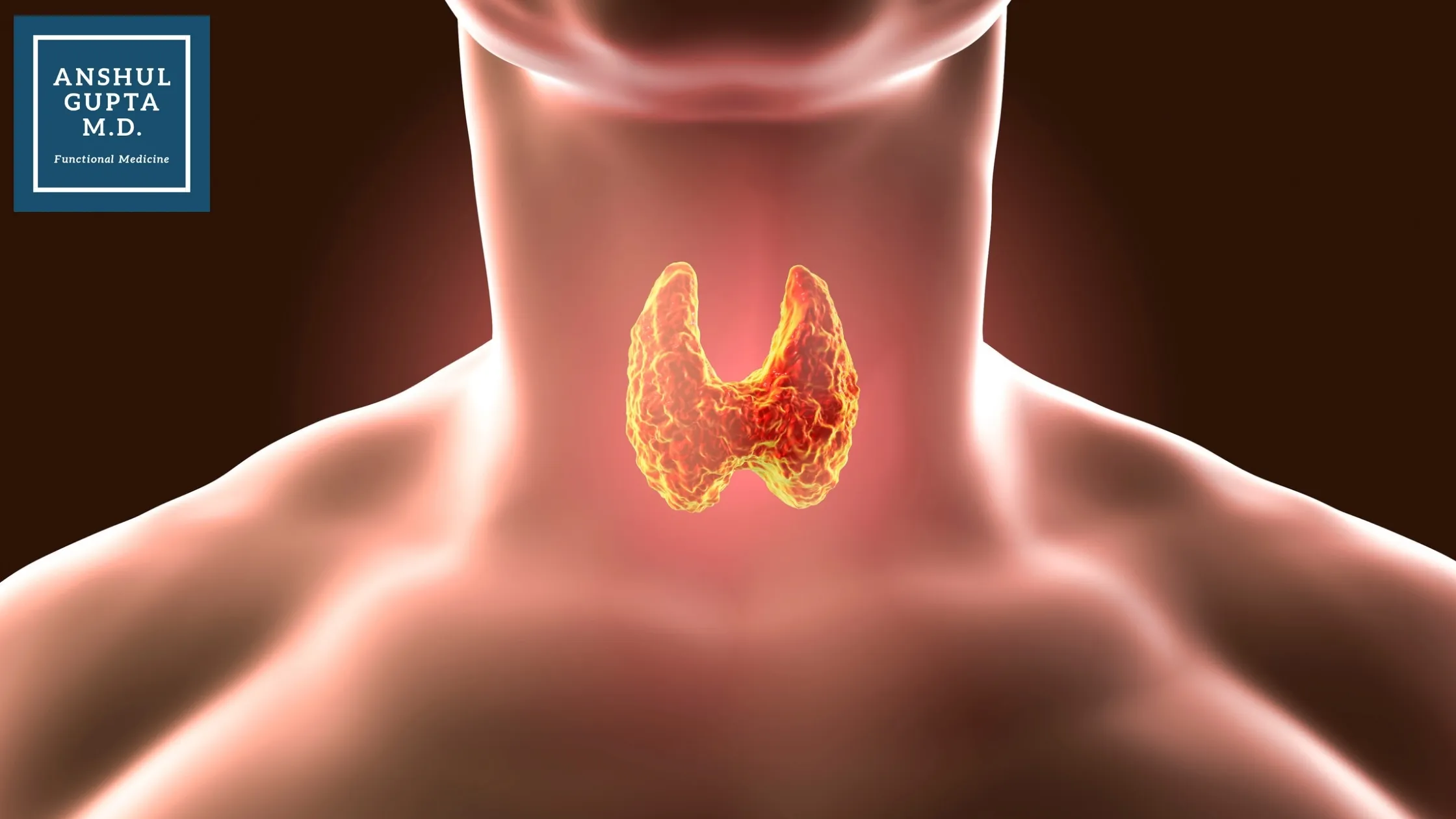 New Delhi, Health, Thyroid Disorder Treatment: Natural & Functional Medicine Approach