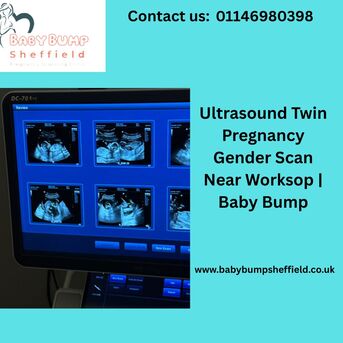 London, Health, Ultrasound Twin Pregnancy Gender Scan Near Worksop | Baby Bump