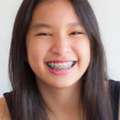Orthodontic Services For Kids & Teens | Smile Squad