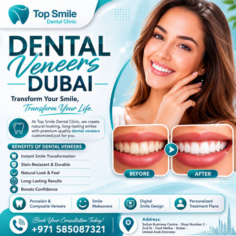 Dubai, Dental, Dental Veneers Dubai &ndash; Get The Perfect Smile At Top Smile Dental Clinic