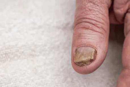 Melbourne, Health, Ballarat Podiatrist