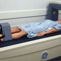 Bone Density Test Etobicoke