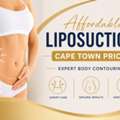 Affordable Liposuction Cape Town Price | Expert Body Contouring