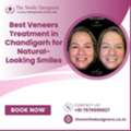 Best Veneers Treatment In Chandigarh For Natural-Looking Smiles