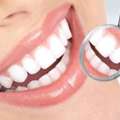 USD 100,  Cosmetic Dentistry Services , Transform Your Smile