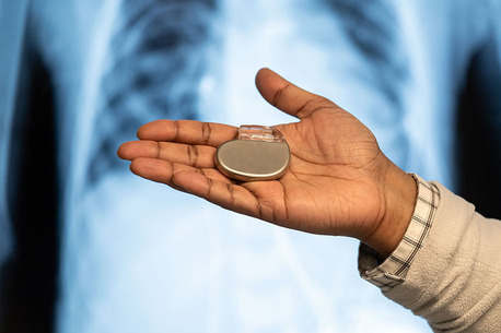 Dubai, Health, Advanced Pacemaker Treatment At TheHeart.ae In UAE