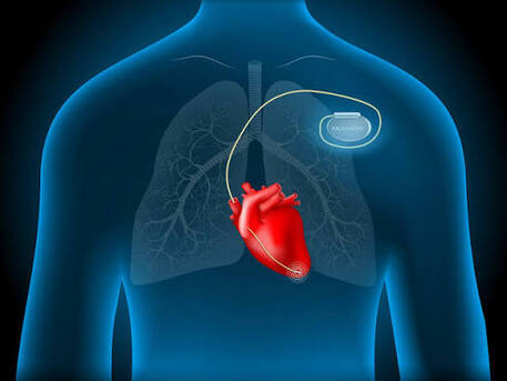 Abu Dhabi, Health, Cardiac Battery Programming And Testing In Abu Dhabi | Bone Care One Day Surgery Center