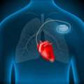 Cardiac Battery Programming And Testing In Abu Dhabi | Bone Care One Day Surgery Center