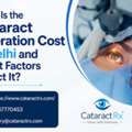 What Is The Cataract Operation Cost In Delhi And What Factors Affect It?