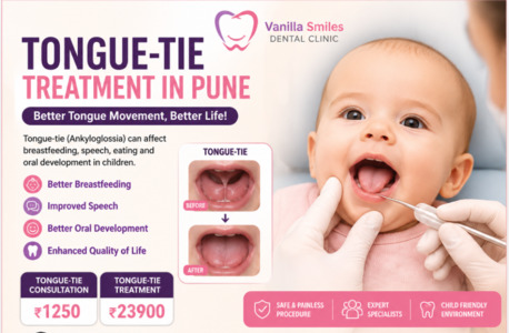 Pune, Dental, Affordable Tongue-Tie Treatment In Pune | Expert Pediatric Dental Care