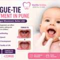 Affordable Tongue-Tie Treatment In Pune | Expert Pediatric Dental Care