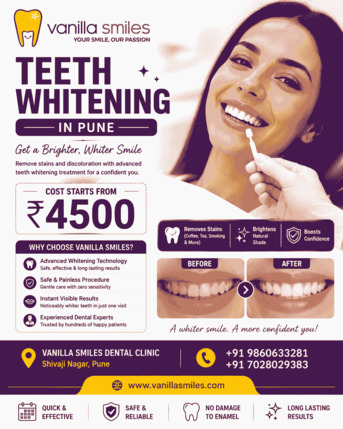 Pune, Dental, Teeth Whitening In Pune | Brighten Your Smile Starting At ₹4500