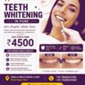 Teeth Whitening In Pune | Brighten Your Smile Starting At ₹4500