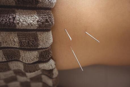 San Francisco, Health, Natural Wellness With Acupuncture San Francisco Services