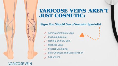New Delhi, Health, Varicose Veins Doctor In Delhi | Minimally Invasive Vein Treatment - Dr Akash Bansal