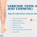 Varicose Veins Doctor In Delhi | Minimally Invasive Vein Treatment - Dr Akash Bansal