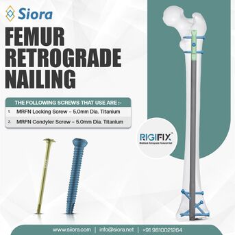 Cape Town, Health, Strengthening Distal Femur Fracture Management With Retrograde Nailing Solutions