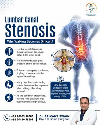 Kurnool, Health, Lumbar Canal Stenosis Treatment In Bhubaneswar | Dr. Srikant Swain.