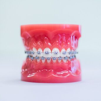 Dubai, Health, TMJ Disorder Treatment By Top Orthodontist Specialist In Dubai!