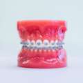 TMJ Disorder Treatment By Top Orthodontist Specialist In Dubai!