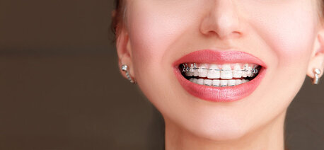 Dubai, Health, TMJ Disorder Treatment By Top Orthodontist Specialist In Dubai!