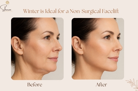 Sydney, Beautician, Why Winter Is Ideal For A Non-Surgical Facelift In Sydney