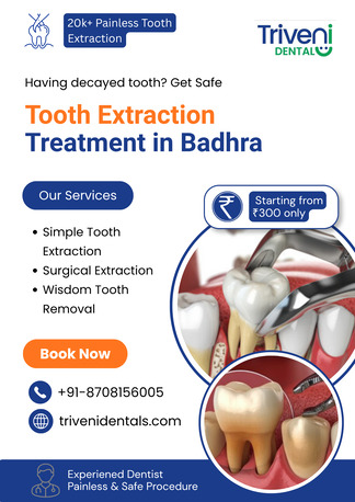 Haryana, Dental, Tooth Extraction Treatment In Badhra | Triveni Dental
