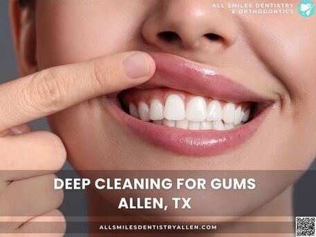 Dallas, Dental, Professional Deep Dental Cleaning In Allen