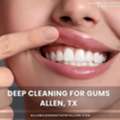 Professional Deep Dental Cleaning In Allen