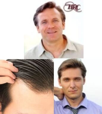 Los Angeles, Beautician, Discover High-Quality Edge Light Hairpieces