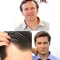 Discover High-Quality Edge Light Hairpieces