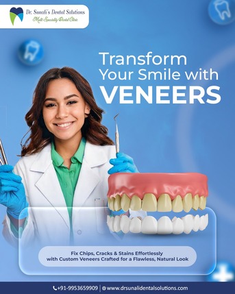 Noida, Dental, Top Veneers In Noida | Get A Confident Smile With Natural-Looking Veneers