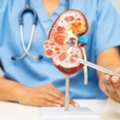 Kidney Stone Specialist In Delhi | Advanced Diagnosis & Expert Treatment
