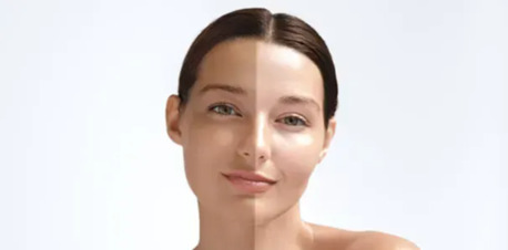 Mumbai, Health, Best Skin Whitening Treatment: Achieve Brighter, Even-Toned, And Healthy Skin