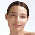 Best Skin Whitening Treatment: Achieve Brighter, Even-Toned, And Healthy Skin