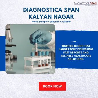 Bangalore, Health, Diagnostic Centre In Kalyan Nagar Bangalore &ndash; Pathology Lab, Blood Test & Home Collection