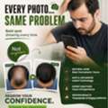 Say Goodbye To Stubborn Skin & Hair Concerns With Expert Care