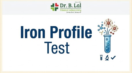 Jaipur, Health & Beauty Items, INR 1100,  Iron Profile For Vegetarians & Vegans | Check Iron Status