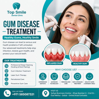 Dubai, Dental, Gum Disease Treatment In Dubai | Top Smile Dental Clinic