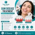 Gum Disease Treatment In Dubai | Top Smile Dental Clinic