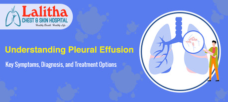 Karimnagar, Health, Understanding Pleural Effusion Symptoms, Diagnosis & Treatment